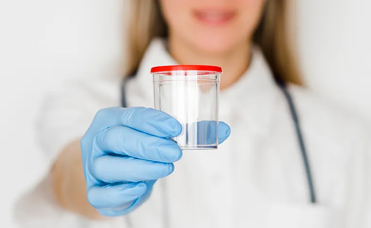 Spermiogram test (sperm test)