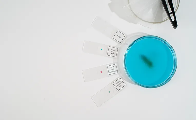 Spermiogram test (sperm test)