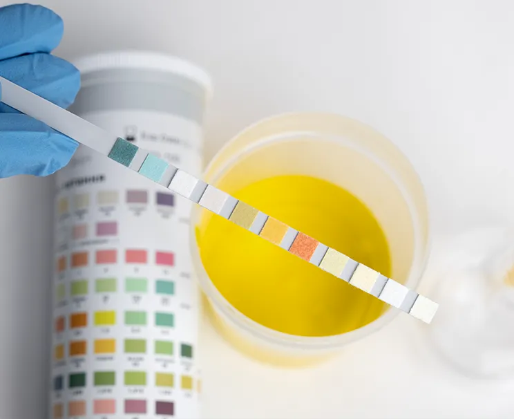 Elevated amylase levels