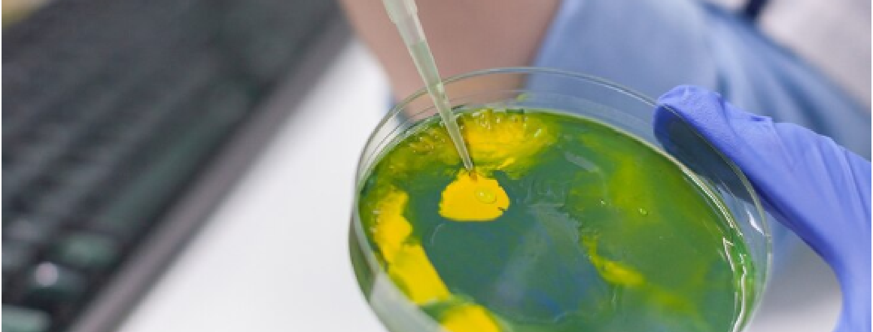 What İs Microbiology