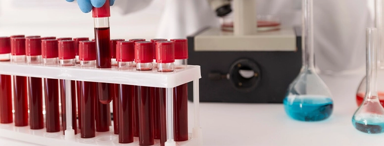 Hemogram Değeri Kaç Olmalı?