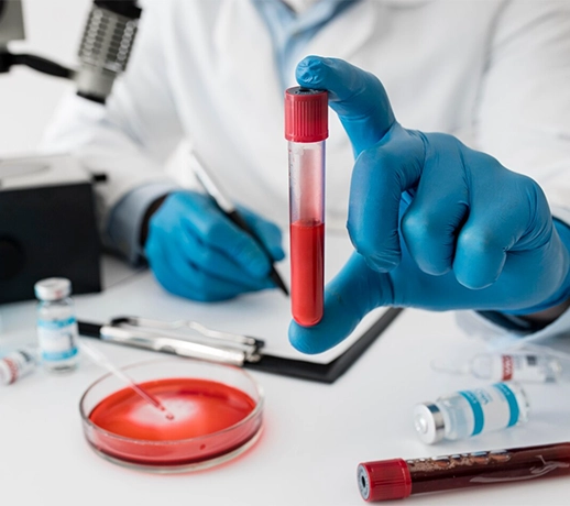 Hemogram Değeri Kaç Olmalı?