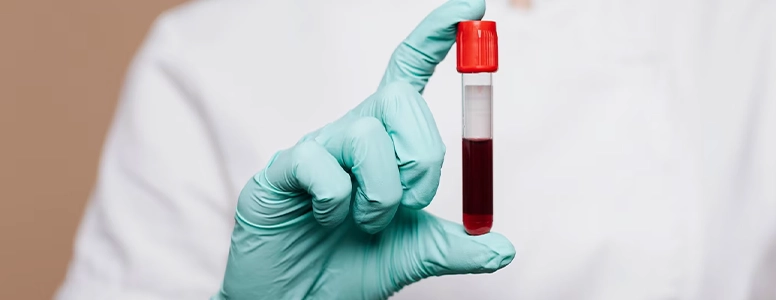 Kaşıntı İçin Kan Testi