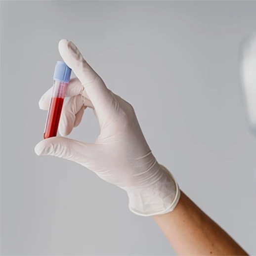 Kaşıntı İçin Kan Testi